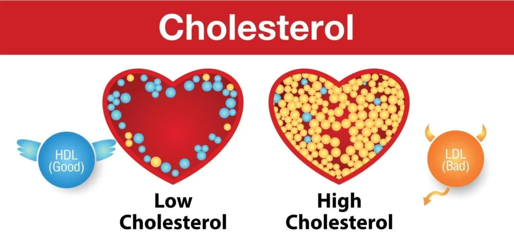 Amgen & Barry Sanders Spotlight Bad Cholesterol Risks in Documentary