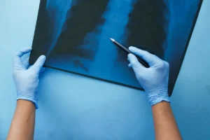 mRNA Therapy